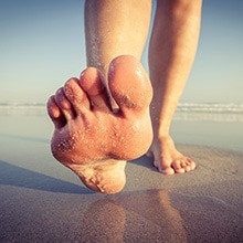 How to get rid of bunions